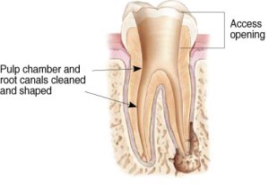 Image of Tooth