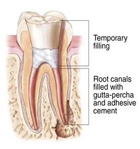 Image of Tooth