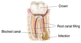 Image of Tooth
