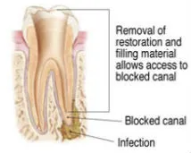 Image of Tooth