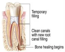 Image of Tooth