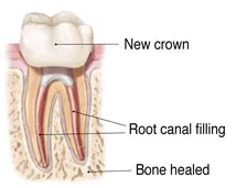 Image of Tooth